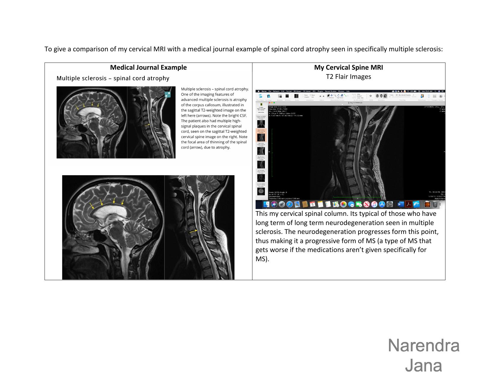 Falsified Discharge Summary