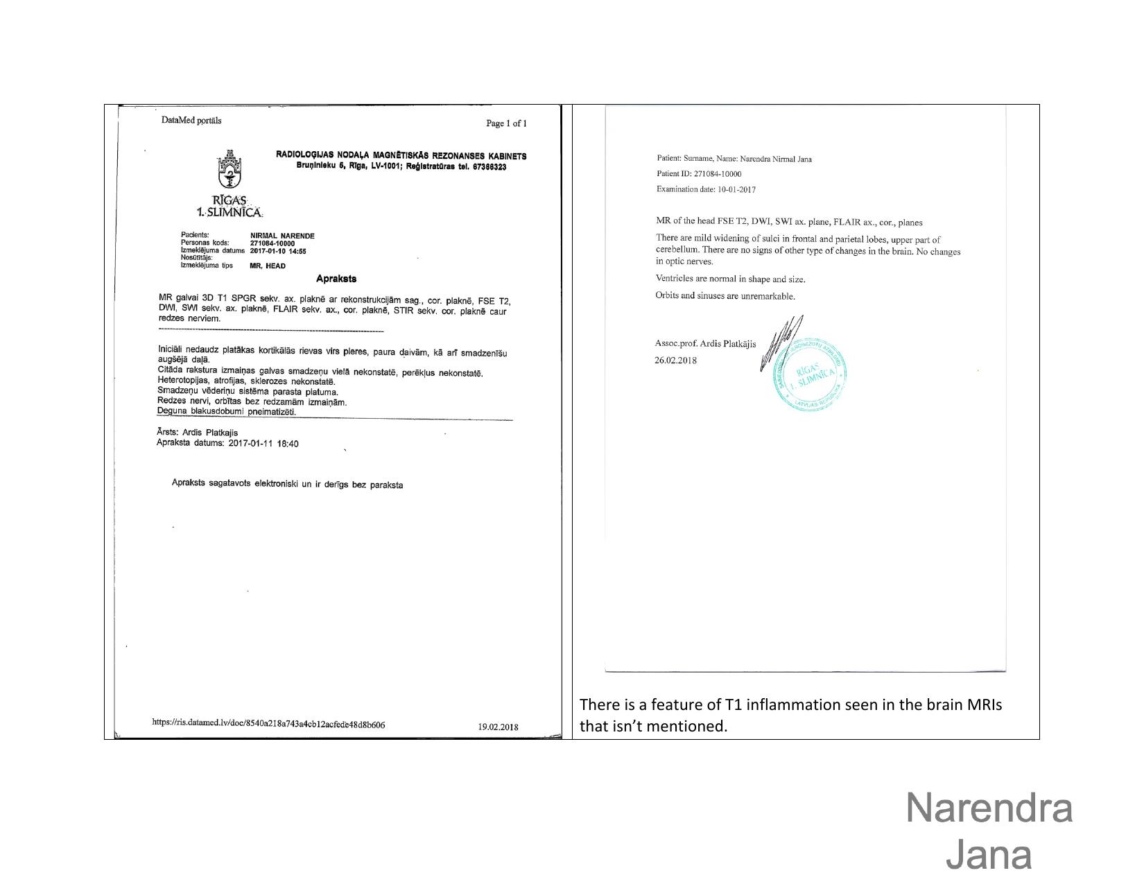 Falsified Discharge Summary